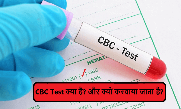 CBC Blood Test in Hindi, What is CBC (c.b.c) Test Price in Hindi
